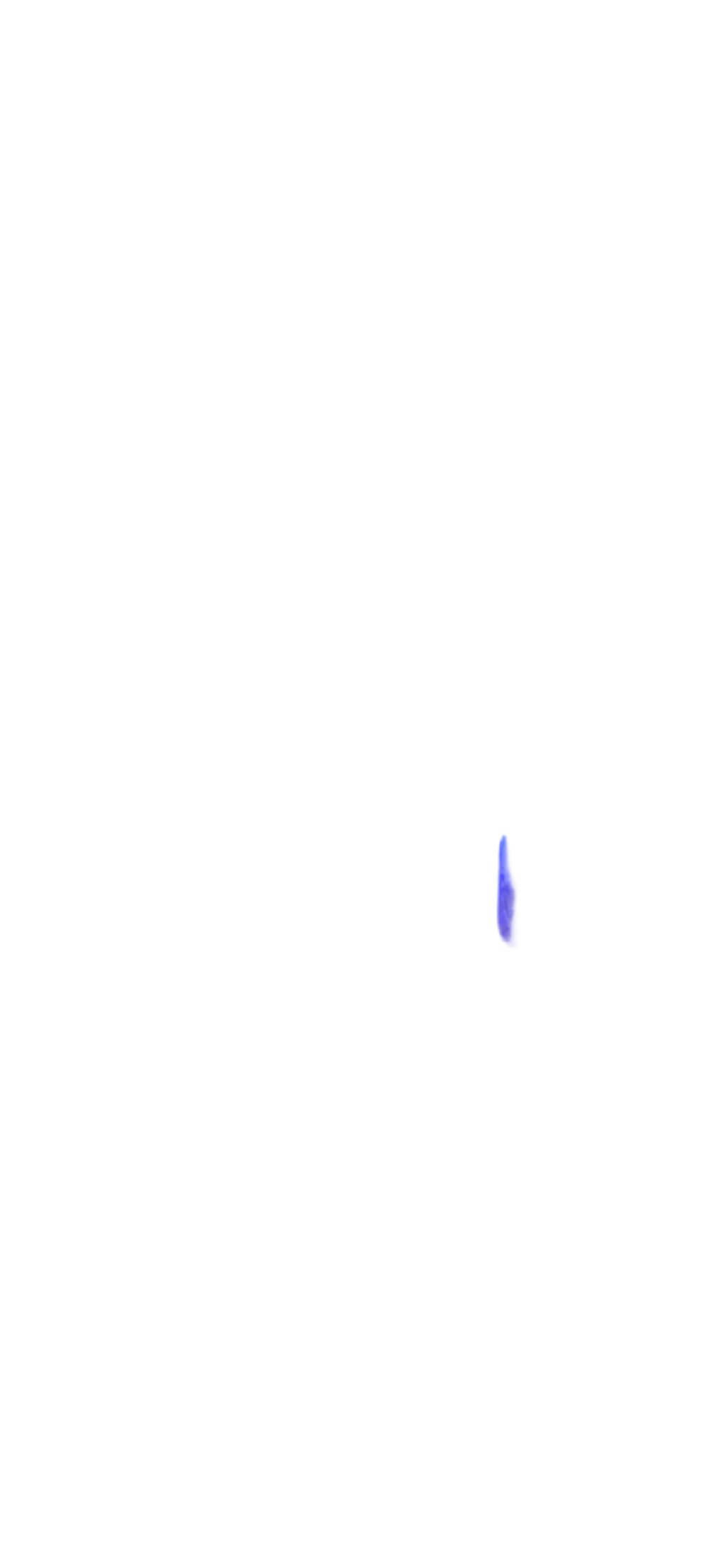 Sea Anemone, a recorded specimen