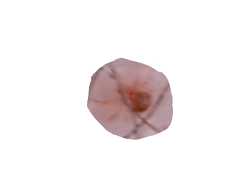 Spider Mite, a recorded specimen